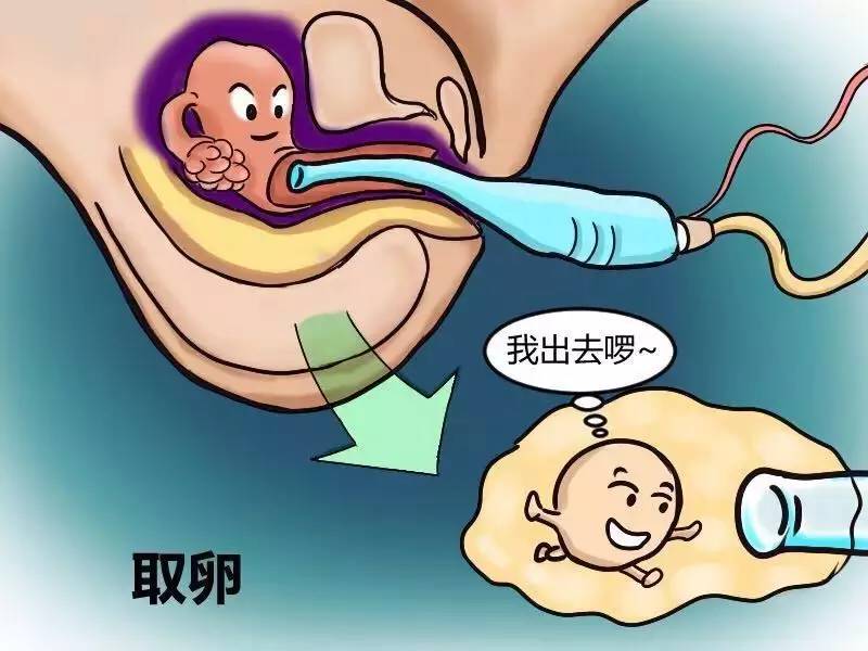 睡不着，去年喜得龙凤胎（赠卵试管），前后花了20w。