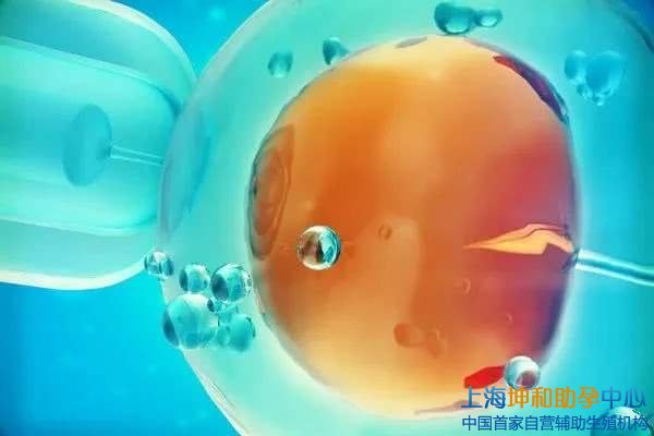 莫斯科供卵做试管公立不用等找孕妈妈排名诚实--俄罗斯供卵做代怀代生技术好吗