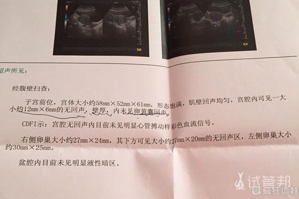 供卵做二代自怀试管移植后要躺多长时间