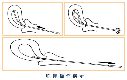 韶关供卵代怀试管成功率高不高一次供卵试管能成功吗