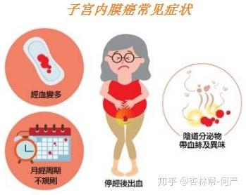 47岁试管婴儿成功案例