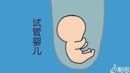代怀男孩却生了女孩移植第二天,是不是必须一直平躺床